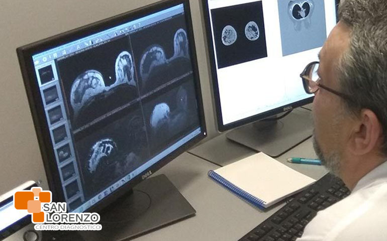 Revisión resonancia mamaria San Lorenzo