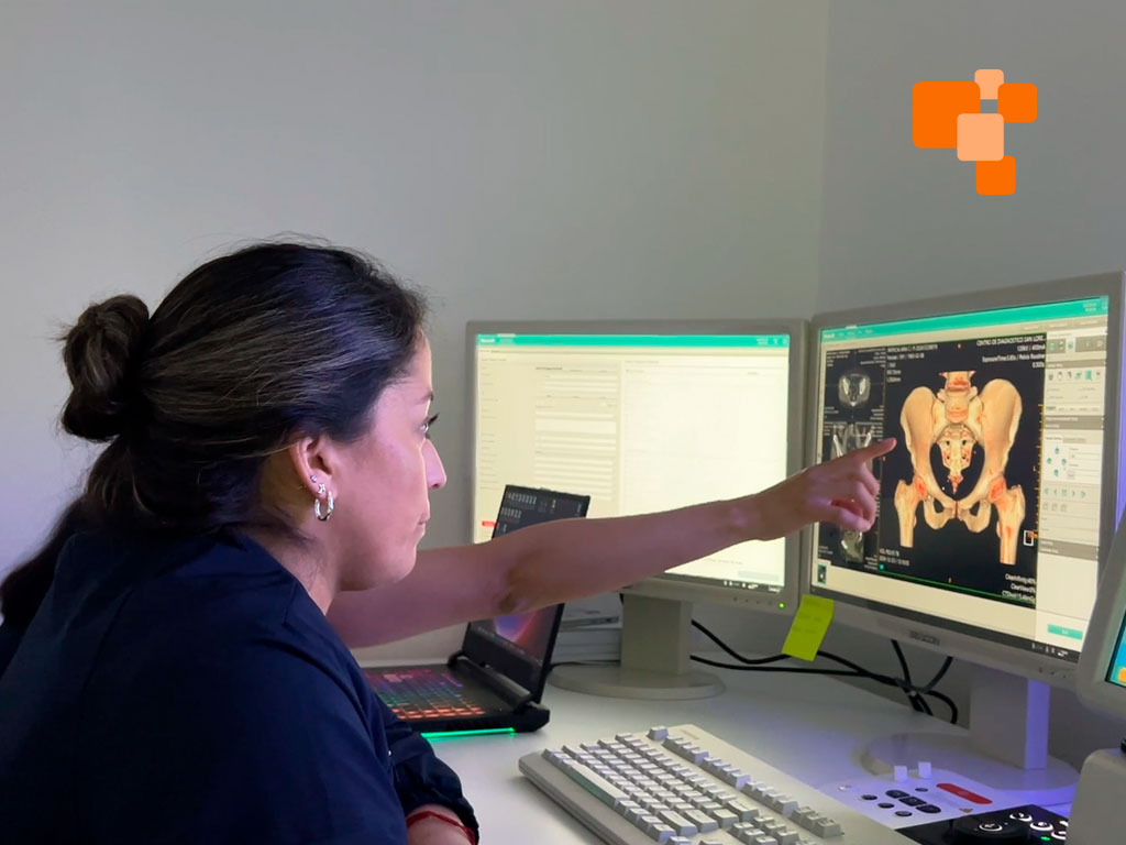 Equipo médico tomando un escáner en imagenología San Lorenzo